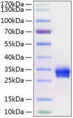 Active Recombinant Human TNFRSF5/CD40 Protein (RP01214)
