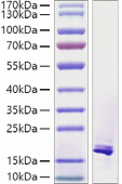 Recombinant Human TNFSF12/TWEAK Protein (RP01446)