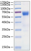 Active Recombinant Human TNFRSF10D/DcR2/TRAIL-R4 Protein (RP00992)