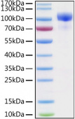 Active Recombinant Human ErbB-3/HER3 Protein (RP00083)