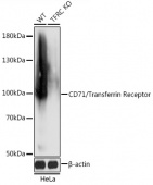 [KO Validated] CD71/Transferrin Receptor Rabbit pAb (A18083)