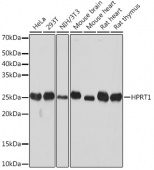 [KO Validated] HPRT1 Rabbit mAb (A8783)