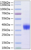 Recombinant Human Ep-CAM/TROP-1/CD326 Protein (RP00073)