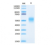 Recombinant Human IL-7RA/CD127 Protein (RP02407)