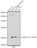SARS-CoV-2 ORF7a Rabbit pAb (A20307)