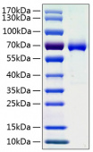 Active Recombinant Human Ephrin-A3/EFNA3 Protein (RP01022)