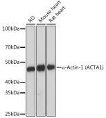 α-Actin-1 (α-SMA) Rabbit mAb (A2235)
