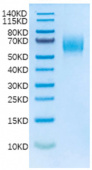 Recombinant Human IL-13RA1/CD213a1 Protein (RP02043)