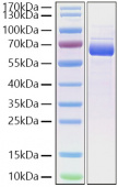 Recombinant Cynomolgus Siglec-15/CD33L3 Protein (RP01292)