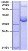 Recombinant Mouse Ep-CAM/TROP-1/CD326 Protein (RP00798)