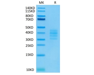 Biotinylated Recombinant Human TNFRSF17/BCMA/CD269 Trimer Protein (RP02287)