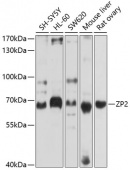 ZP2 Rabbit pAb (A10126)
