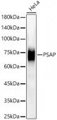 [KD Validated] PSAP Rabbit mAb (A22736)