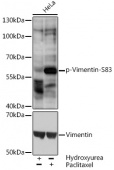 Phospho-VIM-S83 Antibody kit (RK05770)