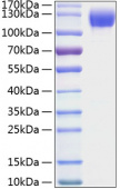 Recombinant Mouse ICAM-1/CD54 Protein (RP01056)