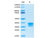 Biotinylated Recombinant Human Oncostatin-M/OSM Protein (RP02464)