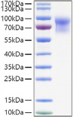 Recombinant Mouse IL-15RA/CD215 Protein (RP01373)