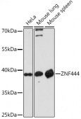 ZNF444 Rabbit pAb (A18470)
