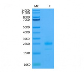 Recombinant Human TRAIL-R1/CD261 Protein (RP02082)