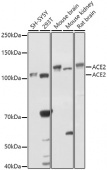 ACE2 Rabbit pAb (A12737)