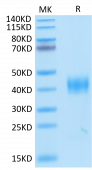 Recombinant SARS-CoV Spike RBD  Protein (RP02481)