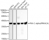 [KD Validated] PKA C-alpha (PRKACA) Mouse mAb (A21869)