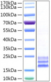 Recombinant Human CEACAM8/CD66b Protein (RP02155)