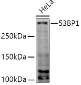 53BP1 Rabbit pAb (A5757)