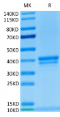 Recombinant Human TNFRSF17/BCMA/CD269 Protein (RP02285)