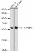 β-TrCP/BTRC Rabbit pAb (A18232)