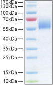 Recombinant Human IL-36R/IL-1Rrp2/IL1RL2 Protein (RP01435)