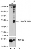 Phospho-NDRG1-S330 Antibody kit (RK05769)