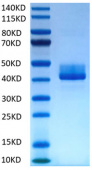 Recombinant Human TNFRSF13C/BAFF-R/CD268 Protein (RP02023)