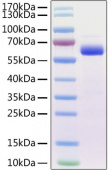Recombinant Mouse Siglec-15/CD33L3 Protein (RP01290)