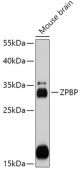 ZPBP Rabbit pAb (A17625)