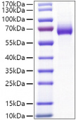 Recombinant Mouse IL-2-RA/CD25 Protein (RP01481)