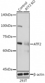 [KO Validated] ATF2 Rabbit pAb (A2155)