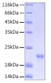 Recombinant Human IL-6 Protein (RP00004)