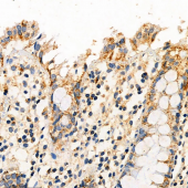 Anti -ADPGK Rabbit pAb