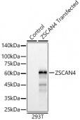 ZSCAN4 Rabbit pAb (A12015)