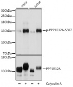 Phospho-PPP1R12A-S507 Antibody kit (RK04097)