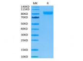Recombinant Human IL-17RA/CD217 Protein (RP02395)