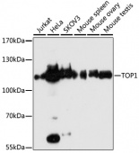[One Step]TOP1 Antibody Kit (RK05716)