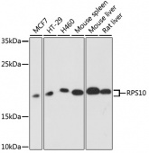[One Step]RPS10 Antibody Kit (RK05701)