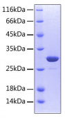 Recombinant Human TNFRSF11A/CD265 Protein (RP00458)