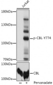 Phospho-CBL-Y774 Antibody kit (RK05788)