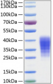 Active Recombinant Human Leukemia inhibitory factor/LIF Protein (RP00089)