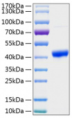 Recombinant Human TNFRSF4/OX40/CD134 Protein (RP01127)