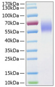 Recombinant Human IL-13RA1/CD213a1 Protein (RP01032)