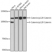 δ-Catenin/p120 Catenin Rabbit mAb (A11399)